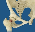 Many diseases increase the risks of hip fracture surgery