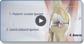 ACL Hamstring