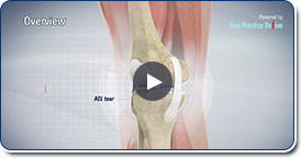 ACL Patellar Tendon