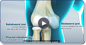 Elbow Fractures