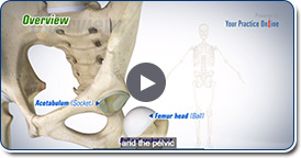 Labral Tears