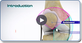 Patellofemoral Instability