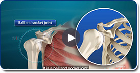 Shoulder Joint Replacement